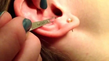 Kulak İçinde Siyah Nokta