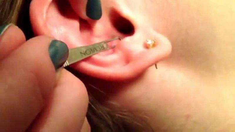 Kulak İçinde Siyah Nokta