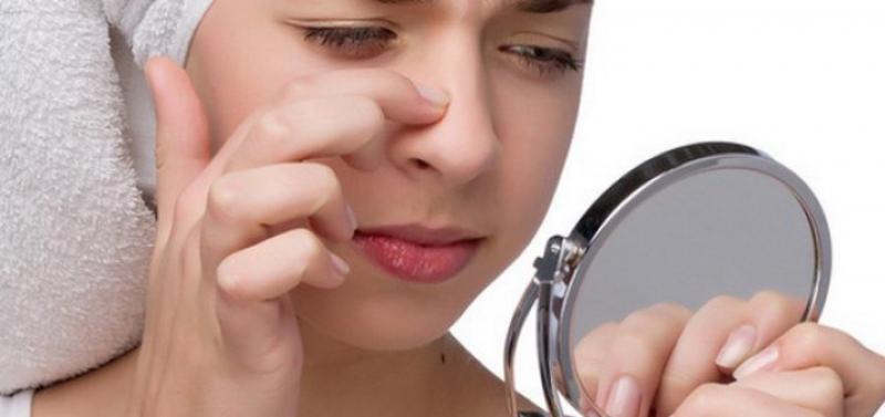 Siyah Nokta ve Sivilce Maskesi