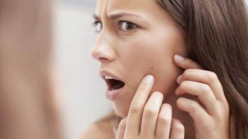 Yağlı Ciltler İçin Siyah Nokta Maskesi